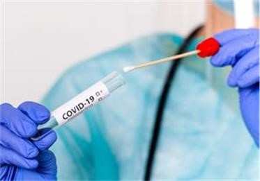 PCR testiranje na Covid-19